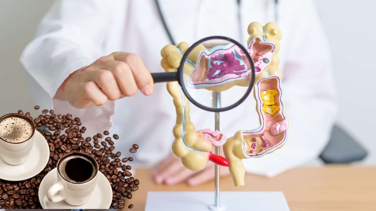  Cà phê giúp ngăn ngừa hội chứng ruột kích thích